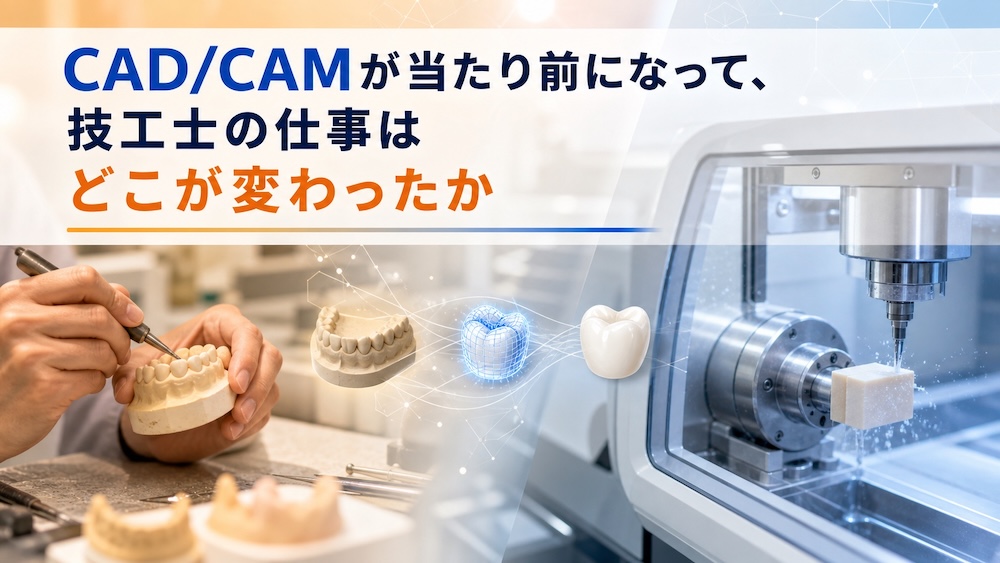 Featured Post Image - CAD/CAMが当たり前になって、技工士の仕事はどこが変わったか